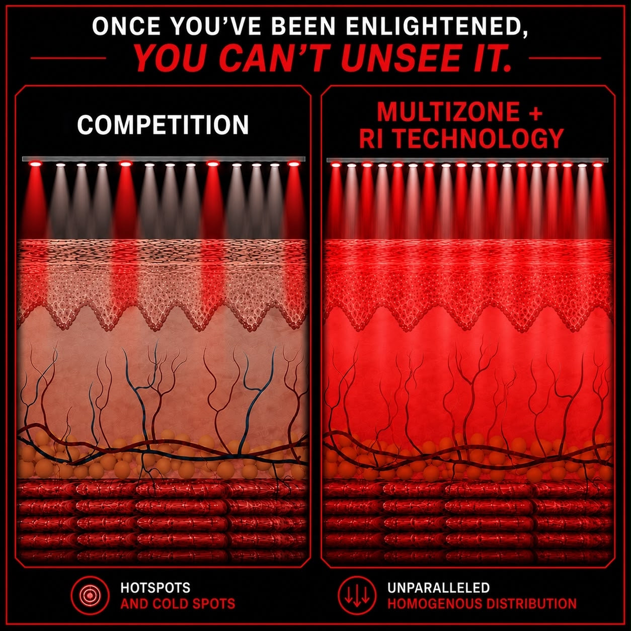 Comparison of traditional light therapy with Lucium topical application and optimized light penetration