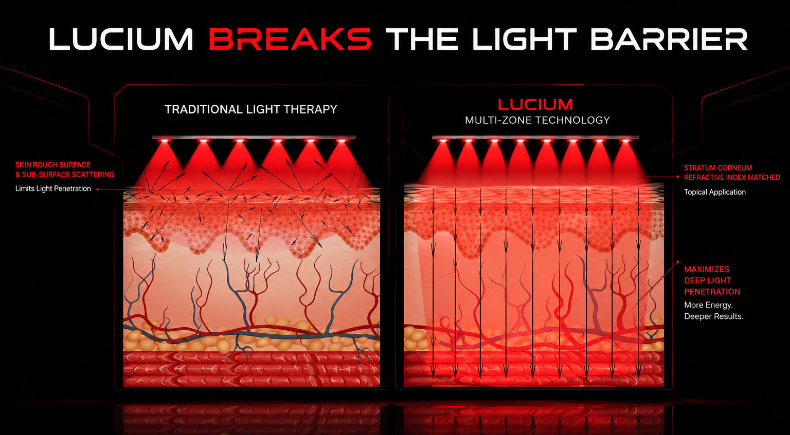 Comparison of traditional light therapy with Lucium topical application and optimized light penetration
